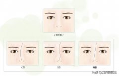 歪鼻整形手術(shù)價(jià)格是多少(歪鼻子手術(shù)多少錢)