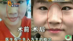 鼻子短塌整形要多少錢(鼻子塌整形需要多少錢)