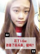 縮小鼻翼微整形多少錢(單純縮小鼻翼大概需要多少錢)