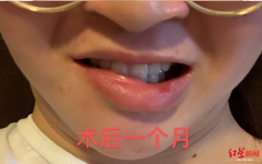內(nèi)江中醫(yī)院整形科電話多少(內(nèi)江整形醫(yī)院有哪些)