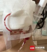 遼寧整形要多少錢(qián)(沈陽(yáng)整形費(fèi)用)