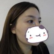 上揚嘴角整形多少錢(上揚嘴角整形多少錢)