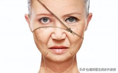 做除皺整形整形多少錢(除皺整形需要多少錢)