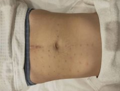 胸部整形整容多少錢(胸部整形整容多少錢啊)