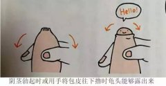 包皮手術(shù)整形多少錢(包皮手術(shù)整形多少錢一次)