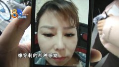 眼睛和鼻子整形多少費(fèi)用(鼻部整形需要多少費(fèi)用)