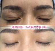 區(qū)整形美容手術(shù)多少錢(整形美容手術(shù)價格)