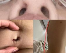 濰坊舉報(bào)整形醫(yī)院電話多少(濰坊附屬醫(yī)院整形醫(yī)院地址)