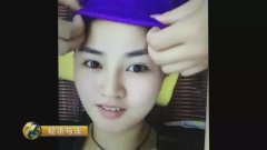 蘇州下巴微整形多少錢(下頜角整容整形多少錢)