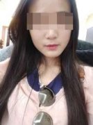 整形要多少歲才可以(做整容手術(shù)可以嗎)
