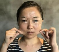 下顎線整形打針多少錢一針(下顎線整形打針多少錢一針)