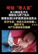 奶頭凹陷整形多少錢(乳頭凹陷矯正大概需要多少錢)