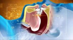 浙二整形鼻梁多少錢(浙二醫(yī)院隆鼻)