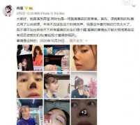 整形失敗的幾率是多少(整容成功概率)