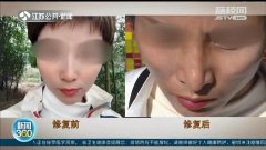 整形醫(yī)院的手術(shù)費用多少(整形醫(yī)院需要多少錢)