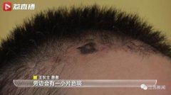 南京鼓樓醫(yī)院整形科多少錢(南京鼓樓醫(yī)院整形外科醫(yī)生)