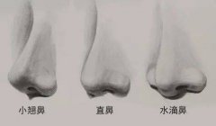 鼻唇溝整形多少錢(鼻唇溝整形手術(shù)醫(yī)院)