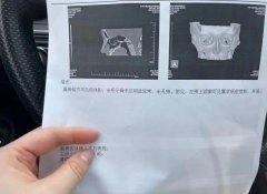鼻部整形多少錢(qián)費(fèi)用(鼻部整形需要多少錢(qián))