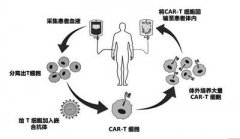燒傷腋窩整形費用多少醫(yī)保(燒傷整形醫(yī)保能報銷嗎)