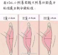 婦科整形得多少錢(整形多少錢啊)