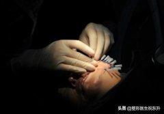 整形臉下部多少錢(面部整形大概需要多少錢)