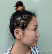 臉博士整形多少錢(qián)找專家(臉型手術(shù)整容價(jià)格)
