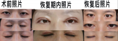 華美做整形多少錢(qián)(華美做整容多少錢(qián))
