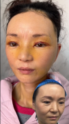 整形要花多少錢合適回復(fù)(整形大概需要多少錢)