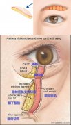 皺眉整形費用多少(眉毛美容整形要多少錢)
