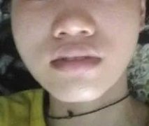 上海鼻翼整形多少錢(上海鼻翼整形多少錢)