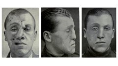 整形鼻子骨折多少錢(qián)(鼻子骨折多少錢(qián)能弄好)