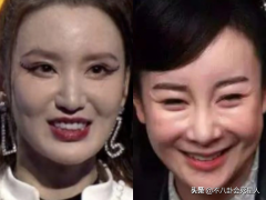 陳志朋整形隆鼻多少錢(廣州整容鼻子要多少錢)