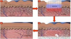 倫琴防曬霜日本哪個品牌(倫琴防曬霜日本哪個品牌好用)